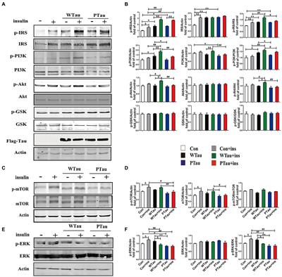 The identities of insulin signaling pathway are affected by overexpression of Tau and its phosphorylation form